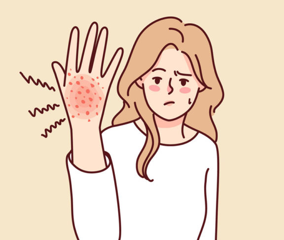Unhappy woman suffer from rash on hand