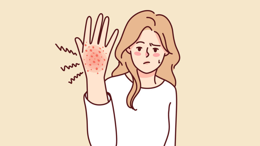 Unhappy woman suffer from rash on hand