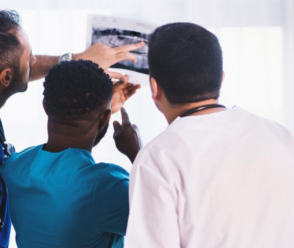 Osteoporosis in Ireland and preventable fractures